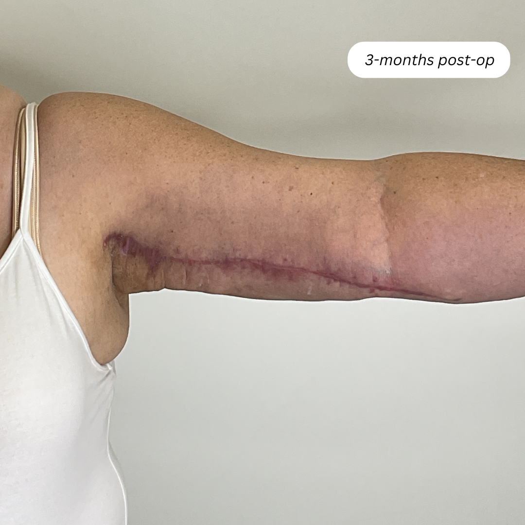 Website before afters procedure page (2)